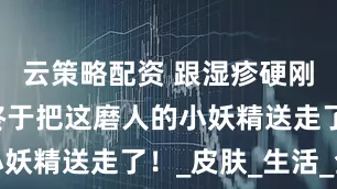 云策略配资 跟湿疹硬刚 3 年，终于把这磨人的小妖精送走了！_皮肤_生活_全掏